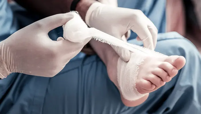 Người tiểu đường nên băng vết loét đúng kỹ thuật