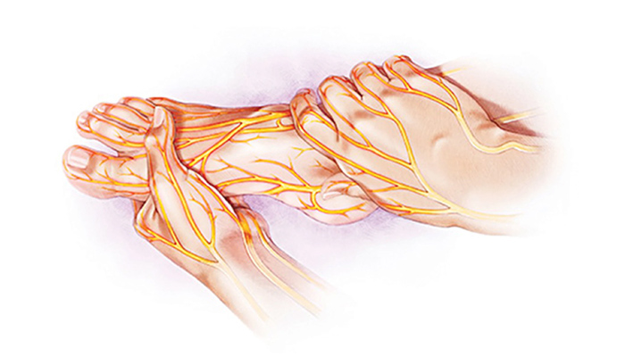 Bệnh thần kinh ngoại biên