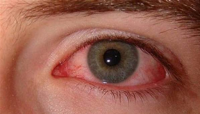 Bệnh võng mạc tiểu đường