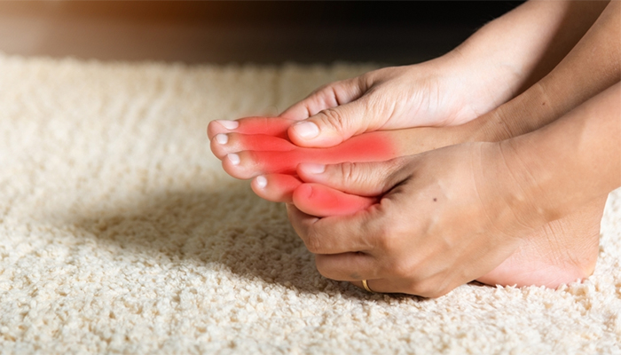 Triệu chứng tê bì ở chân trong biến chứng thần kinh ngoại biên