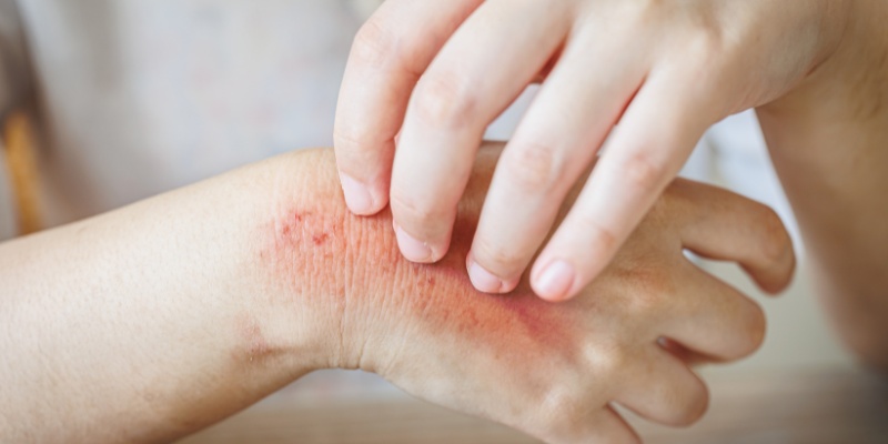 Nhiễm trùng da mô mềm của người bị tiểu đường