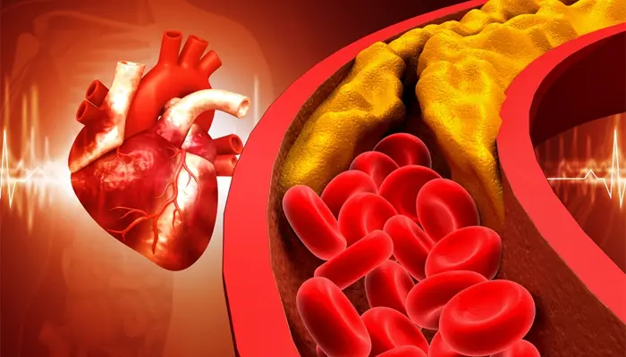 Biến chứng tiểu đường ở người già gây nhồi máu cơ tim, đột quỵ