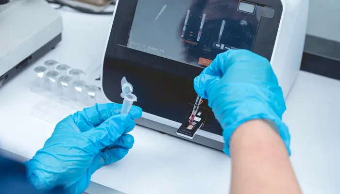 Chỉ số xét nghiệm đường huyết lúc đói là chỉ số được thực hiện khi nhịn ăn từ 8-12 giờ 