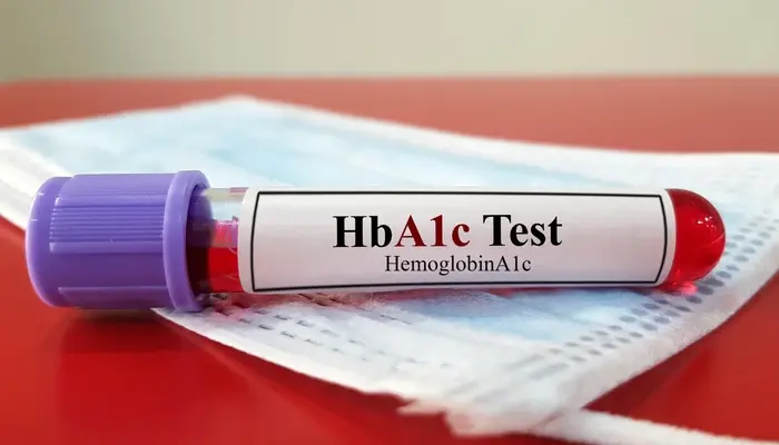 Xét nghiệm HbA1c là một trong số các loại xét nghiệm glucose máu