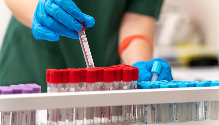 Xét nghiệm tiểu đường thai kỳ được thực hiện thông qua phương pháp dung nạp glucose 