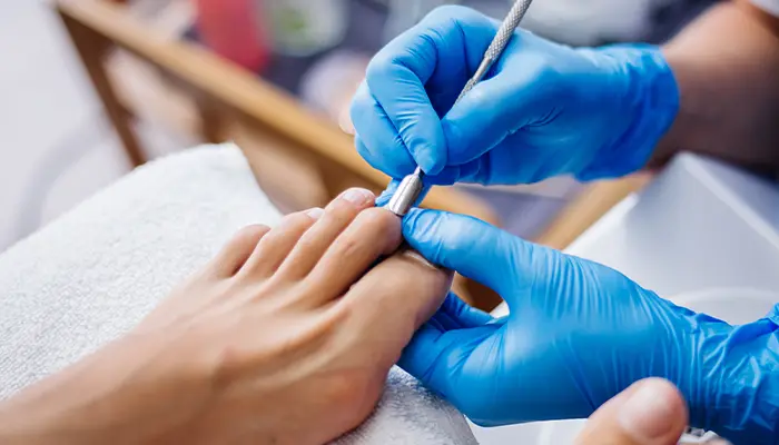 Cắt móng cho người đái tháo đường được không? Vẫn có thể cắt móng nhưng cần đúng cách