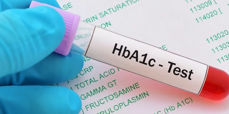 Xét nghiệm HbA1c để chẩn đoán bệnh tiểu đường