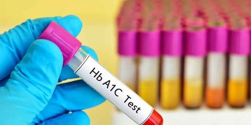 Xét nghiệm HbA1c để chẩn đoán mức đường huyết