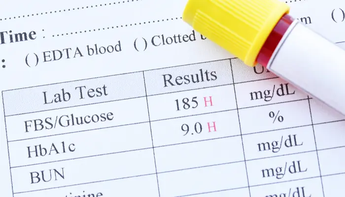 Chỉ số HbA1c bao nhiêu là nguy hiểm? Từ 9% trở lên được coi là mức nguy hiểm 