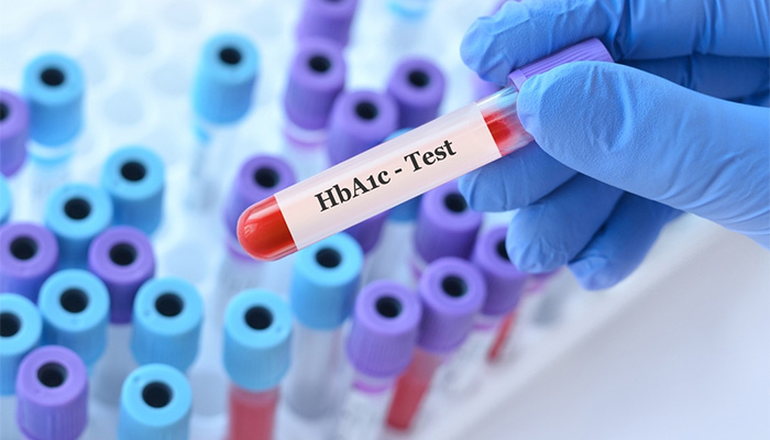 Chỉ số HbA1c thường được dùng trong các xét nghiệm chẩn đoán bệnh tiểu đường