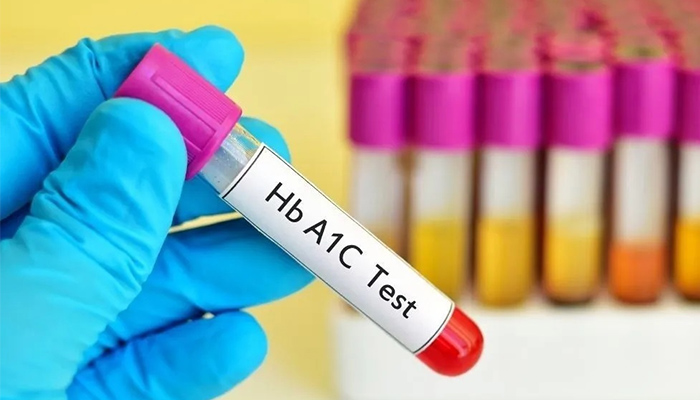 Chỉ số đo đường huyết HbA1c