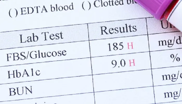 Cách đọc kết quả xét nghiệm tiểu đường thai kỳ cho mẹ bầu chính xác 