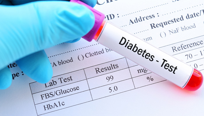 Sau khi xét nghiệm bác sĩ sẽ chẩn đoán dựa vào kết quả