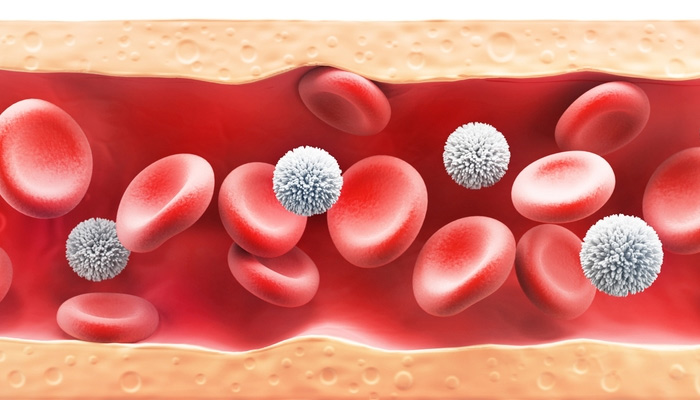Đường trong máu cao là lượng glucose cao hơn mức bình thường