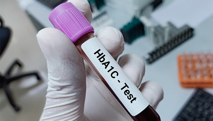 HbA1c tiền tiểu đường