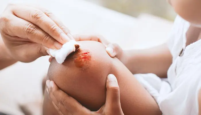 Chăm sóc vết thương cho người tiểu đường được thực hiện theo từng bước cụ thể 
