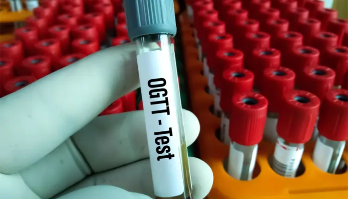 Nghiệm pháp tăng đường huyết là xét nghiệm dụng nạp glucose đường huyết để chẩn đoán tiểu đường 