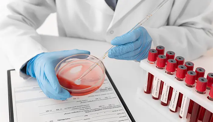 Xét nghiệm dung nạp glucose đường uống cũng là phương pháp xét nghiệm tiểu đường thai kỳ 