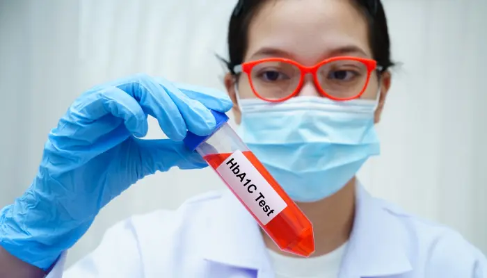 Xét nghiệm HbA1c được diễn ra với quy trình rõ ràng 