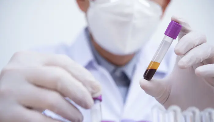 Xét nghiệm nghiệm pháp tăng đường huyết được thực hiện với quy trình rõ ràng 