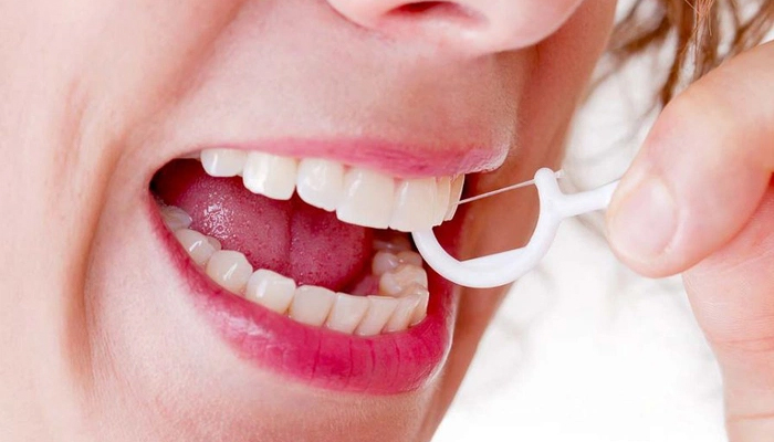 Nên sử dụng chỉ nha khoa để chăm sóc răng miệng