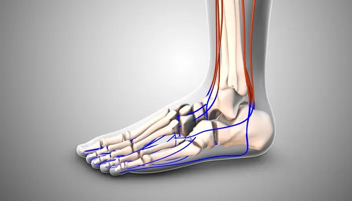 Tổn thương thần kinh cũng là yếu tố có thể gây loét chân ở người tiểu đường