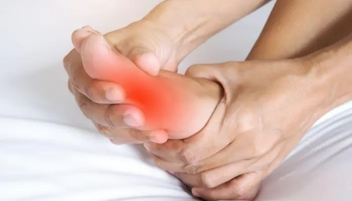 Nóng rát bàn chân ở người tiểu đường là tình trạng bàn chân bị nóng bỏng khó chịu