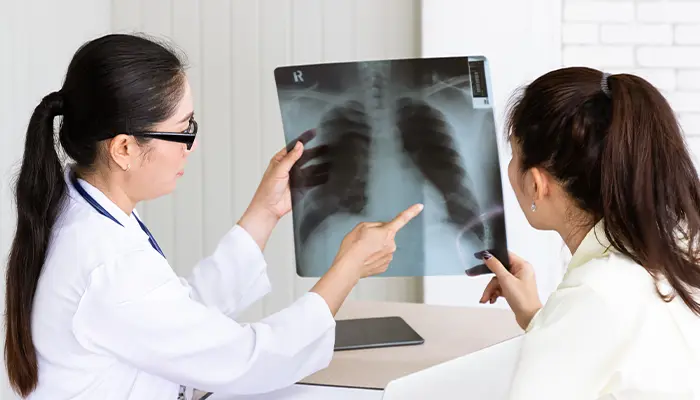 Bệnh lao phổi và tiểu đường có mối quan hệ tác động hai chiều nguy hiểm