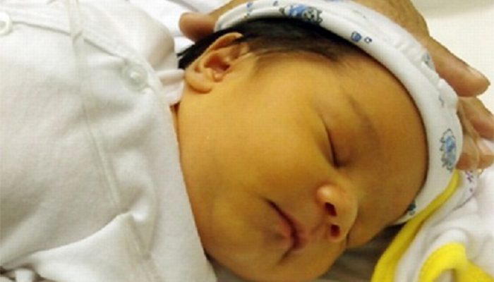 Trẻ bị vàng da sơ sinh