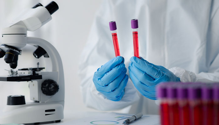 Xét nghiệm dung nạp glucose đường uống