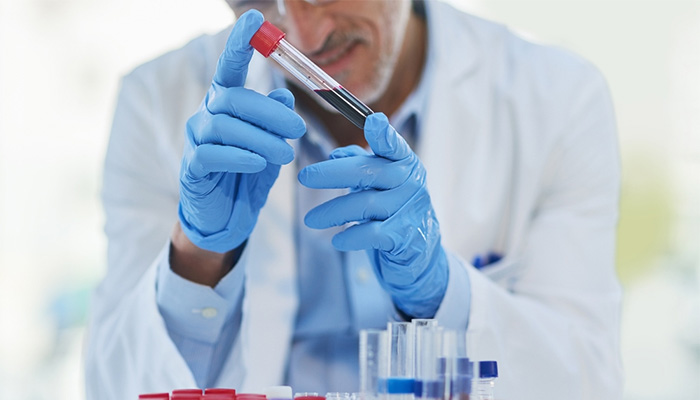 Xét nghiệm đường huyết lúc đói