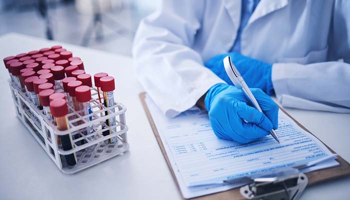 Xét nghiệm đường huyết lúc đói được thực hiện sau khi nhịn ăn ít nhất 8 giờ