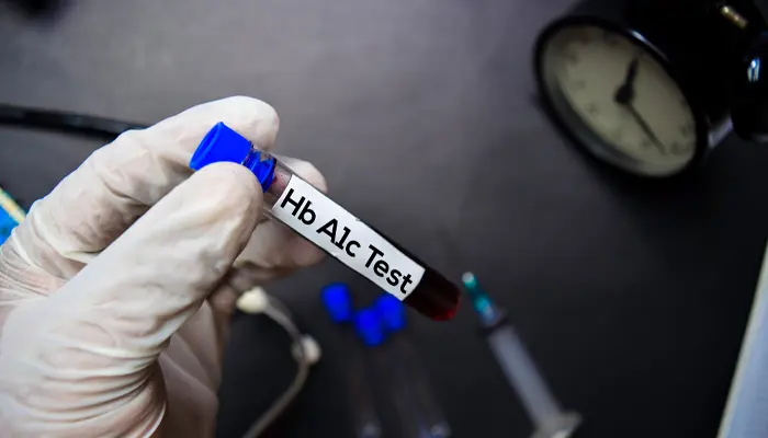 Xét nghiệm HaA1c có cần nhịn ăn không? Không cần phải nhịn ăn 