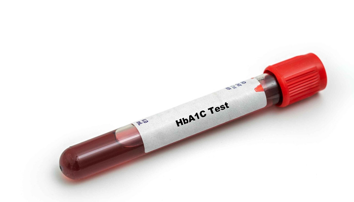 Xét nghiệm HbA1c