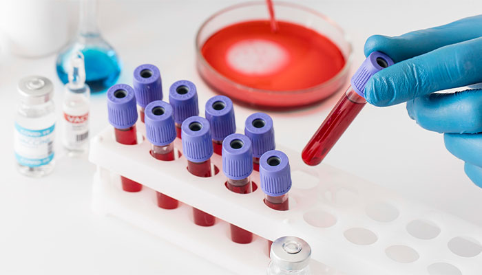 Xét nghiệm máu có phát hiện tiểu đường không? Có