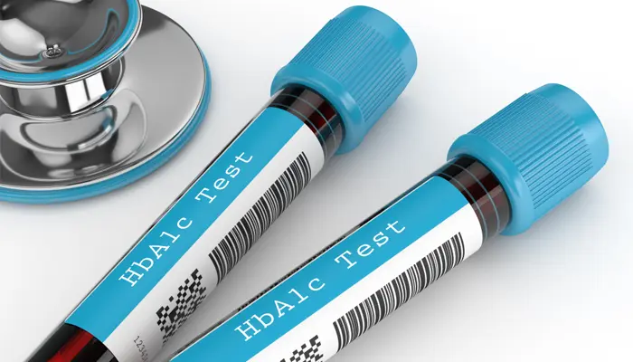 Xét nghiệm HbA1c và đường huyết ngẫu nhiên là không cần phải nhịn ăn 