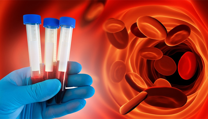 Xét nghiệm tiểu đường là phương pháp dùng để đo chỉ số glucose trong máu