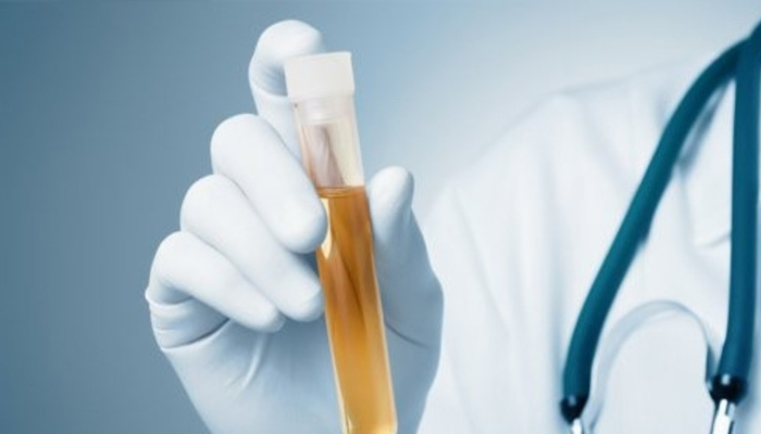 Nên đi khám bác sĩ để xét nghiệm chẩn đoán cps mắc bệnh hay không