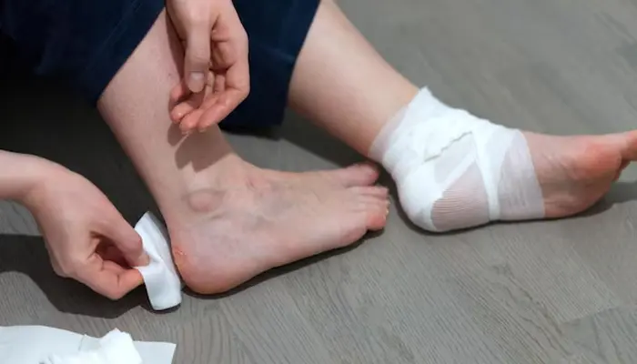 Khi phát hiện các vết xước cần phải làm sạch và chăm sóc đúng cách 