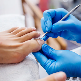 Cắt móng cho người đái tháo đường được không và chăm sóc móng đúng