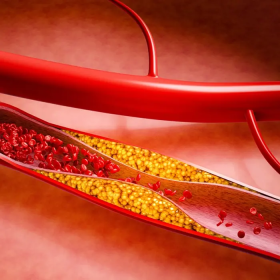 Kháng insulin: Nhận biết sớm qua dấu hiệu và nguyên nhân