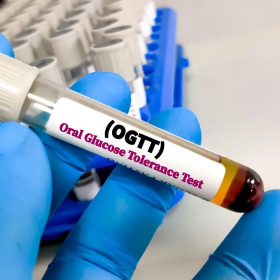 Nghiệm pháp tăng đường huyết là gì? Khi nào cần xét nghiệm?