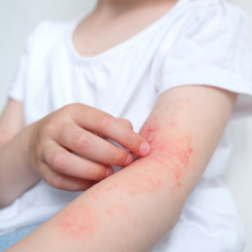 Người bị tiểu đường bị ngứa do đâu? Cách khắc phục hiệu quả