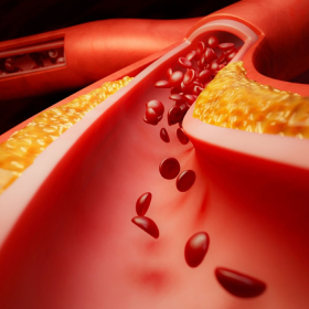 Rối loạn đường huyết ở người mắc tiểu đường: Hiểu đúng để phòng tránh