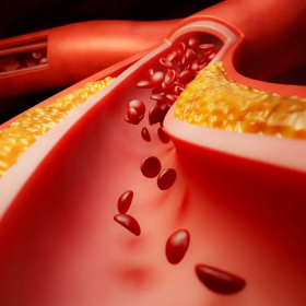 Tăng đường huyết là gì? Nhận biết sớm, nguyên nhân và điều trị