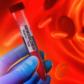 Xét nghiệm tiểu đường: Phân loại, quy trình và ý nghĩa kết quả Xét nghiệm tiểu đường: Phân loại, quy trình và ý nghĩa kết quả